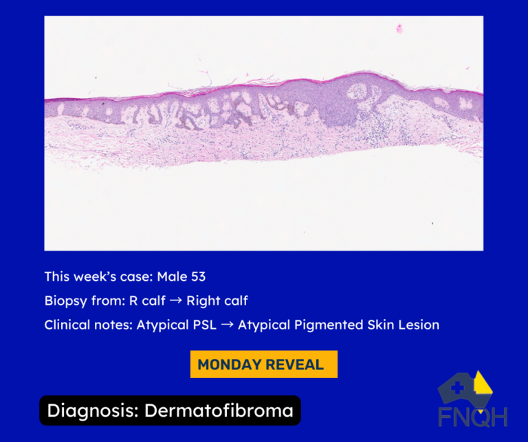 Microscopic Monday 52 NPL (2)