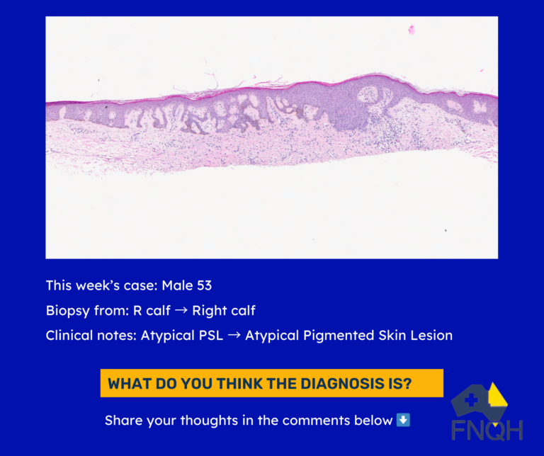 This week’s case A 52-year-old male with a non-pigmented lesion identified during a routine skin check. (3)