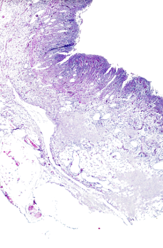 Histopathology Histopathology